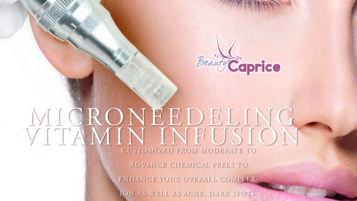 Microneedeling / Vitamin Infusion